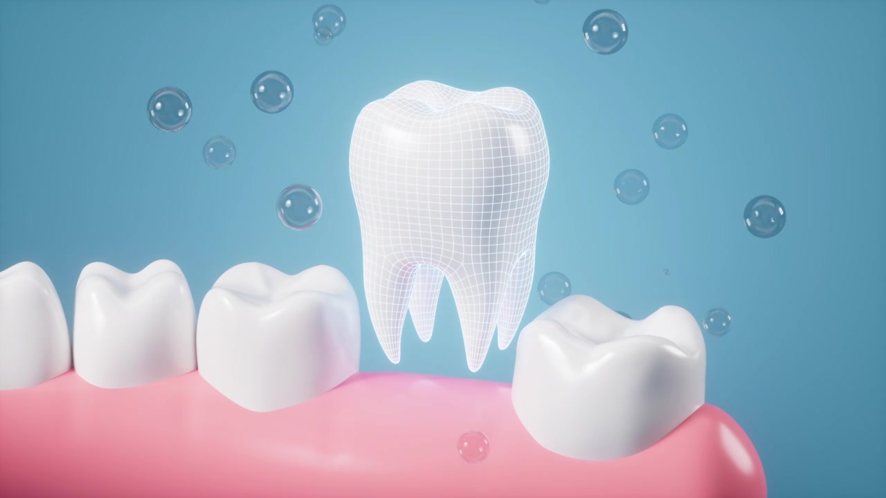 人类牙齿修复假牙植入牙齿动画视频素材