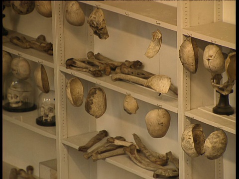 专注于圣巴塞洛缪医院病理学博物馆架子上的骨骼和头骨收藏视频素材
