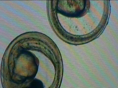放大后的雄性蟑螂精子切片视频素材