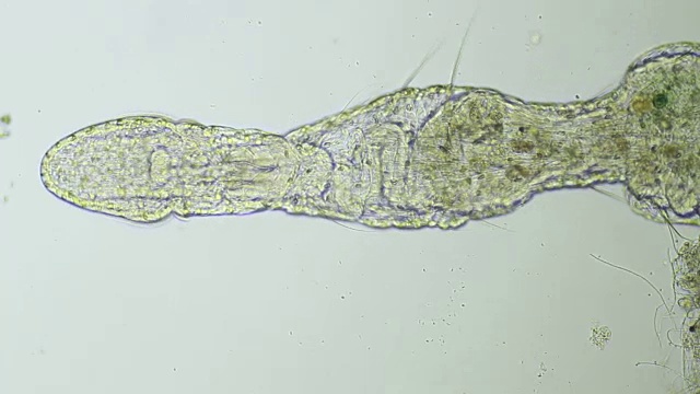 显微镜下的蠕虫-少毛纲Naididae视频素材