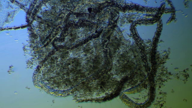 显微镜下的蠕虫-少毛纲Naididae视频素材