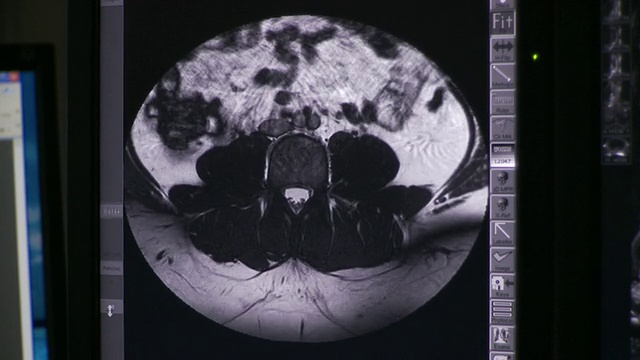 计算机屏幕上的CU PAN x射线和CT扫描和乳房x光图像/南伯灵顿，佛蒙特，美国视频素材