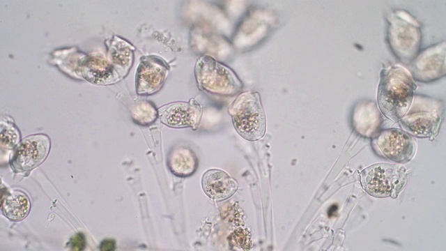 活体涡菌是显微镜下的原生动物属。视频下载