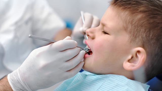 男孩病人在牙科检查时张着嘴，脸部要靠近。用RED摄像机拍摄4K视频素材