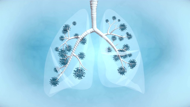 肺大流行疾病- 4K分辨率视频素材