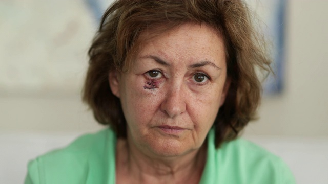 满脸伤痕的老妇人看着镜头，悲伤的情绪视频素材