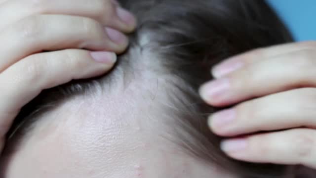 女孩摸她的头发特写，脱发的概念。视频素材