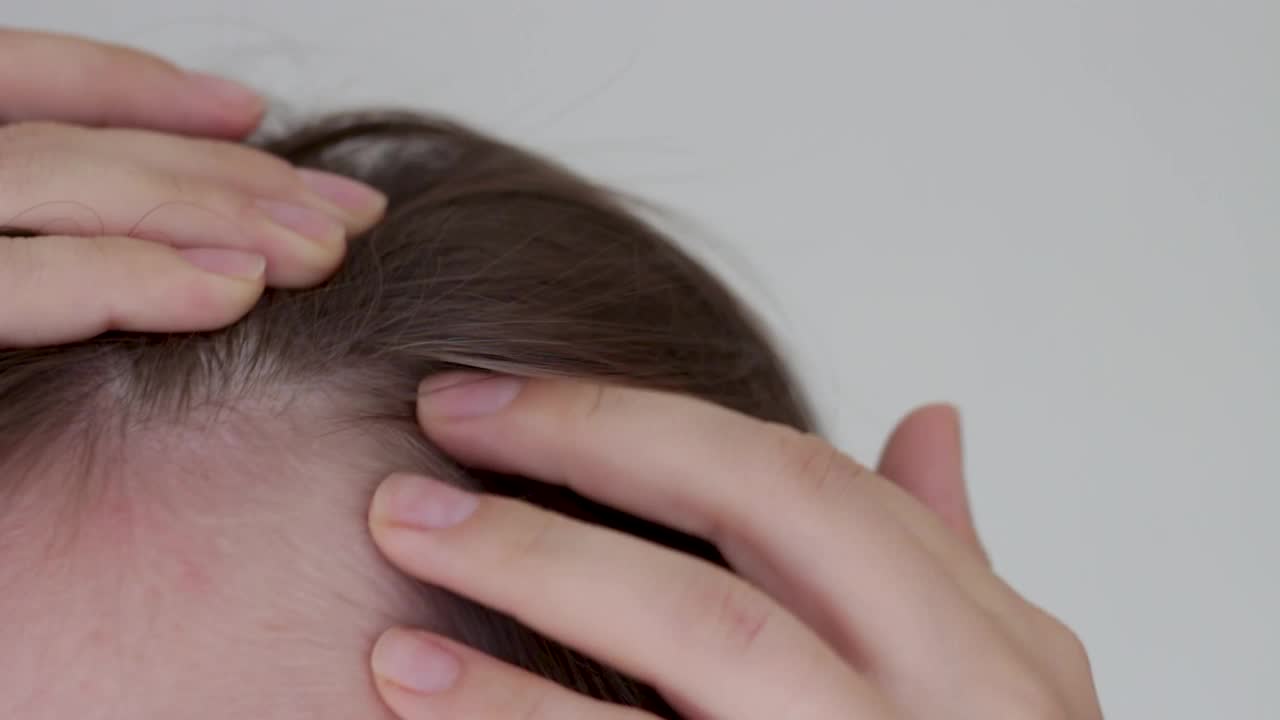 女孩触摸她的头发特写在白色的背景，脱发的概念。视频素材