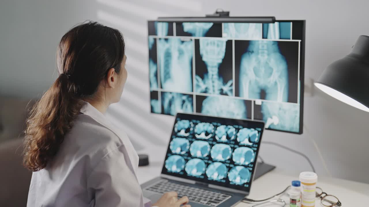 医生工作与X射线图像计算机视频下载