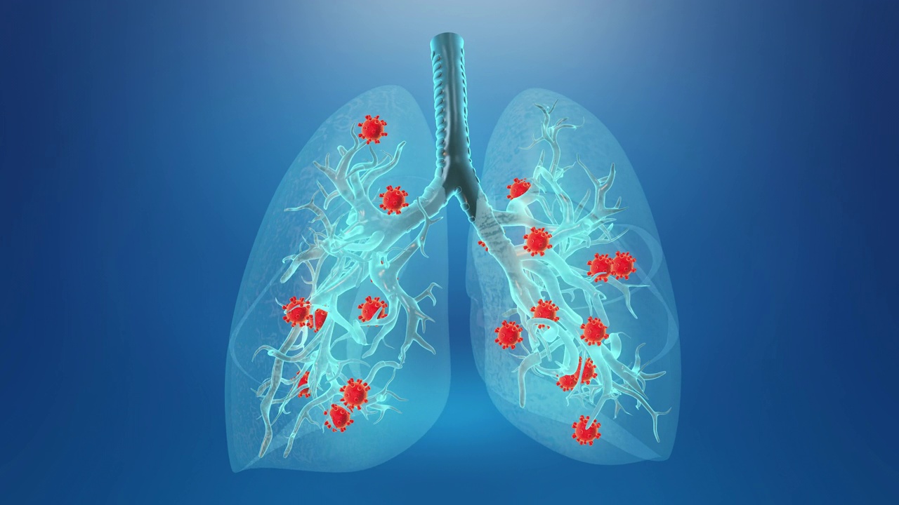 冠状病毒感染人类肺部的背景视频素材