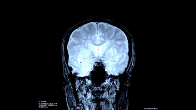 大脑扫描图像视频素材