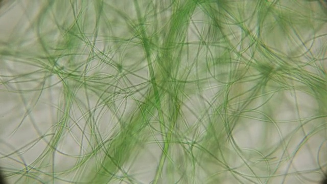 活藻类在显微镜下运动，类似于身体的触须，这很令人兴奋视频素材