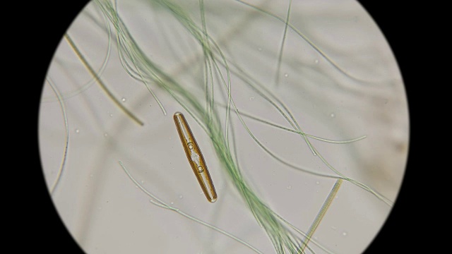 显微镜下硅藻在普通活藻类中的运动视频素材
