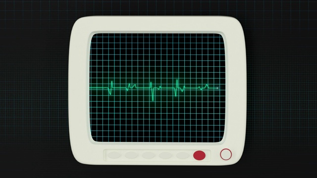 绿色屏幕上的心脏图曲线视频素材