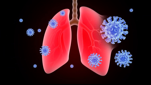 新冠肺炎疫情急性呼吸道综合征COVID-19呼吸道疾病扩散视频素材