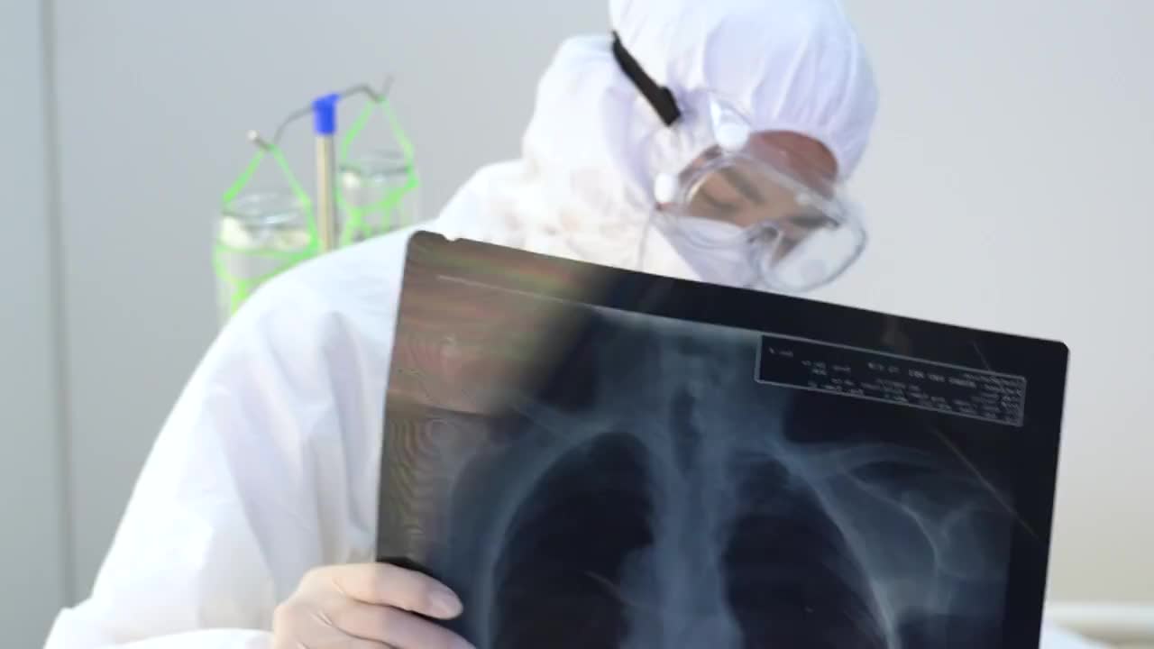 医生给患者查看X光片视频素材