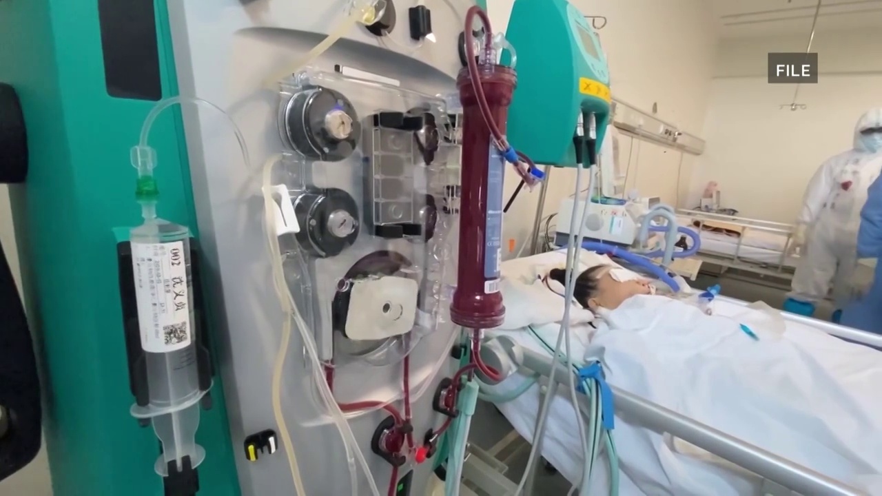 中国医院内部接受治疗的新冠患者视频素材