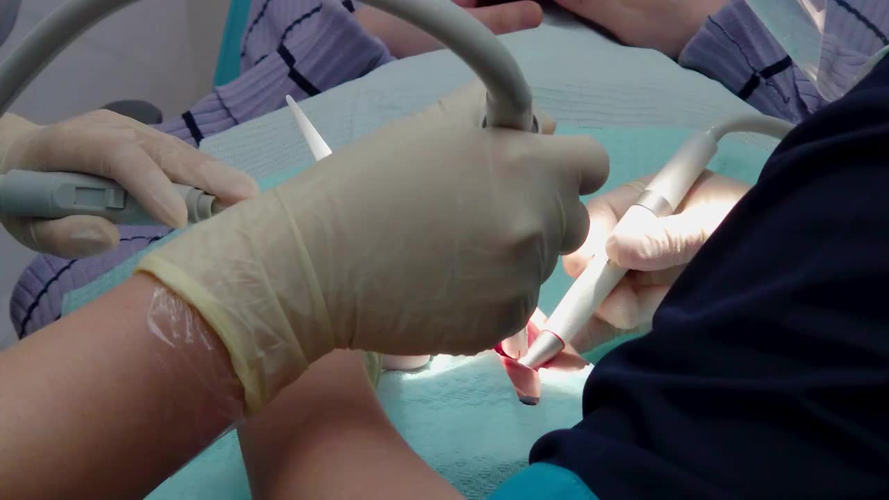 牙医正在给她的病人洗牙视频下载