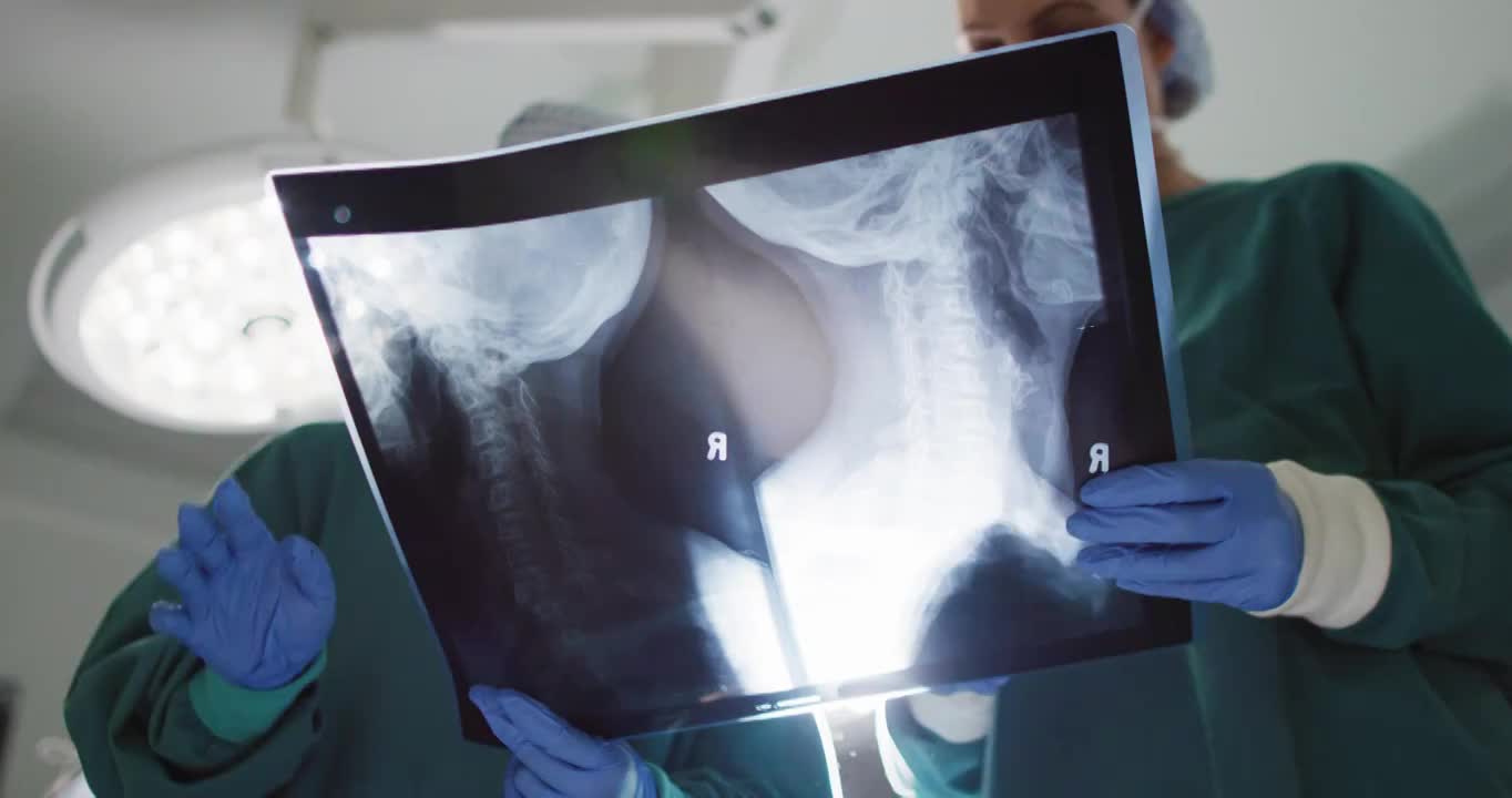 两名不同的女外科医生在手术室讨论x光的低角度视频视频下载