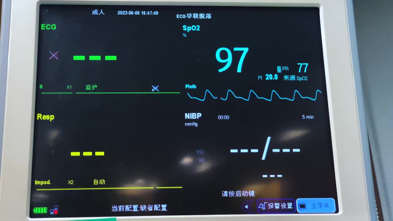 医院医疗设备心电图心电监护仪心率监测仪器视频下载