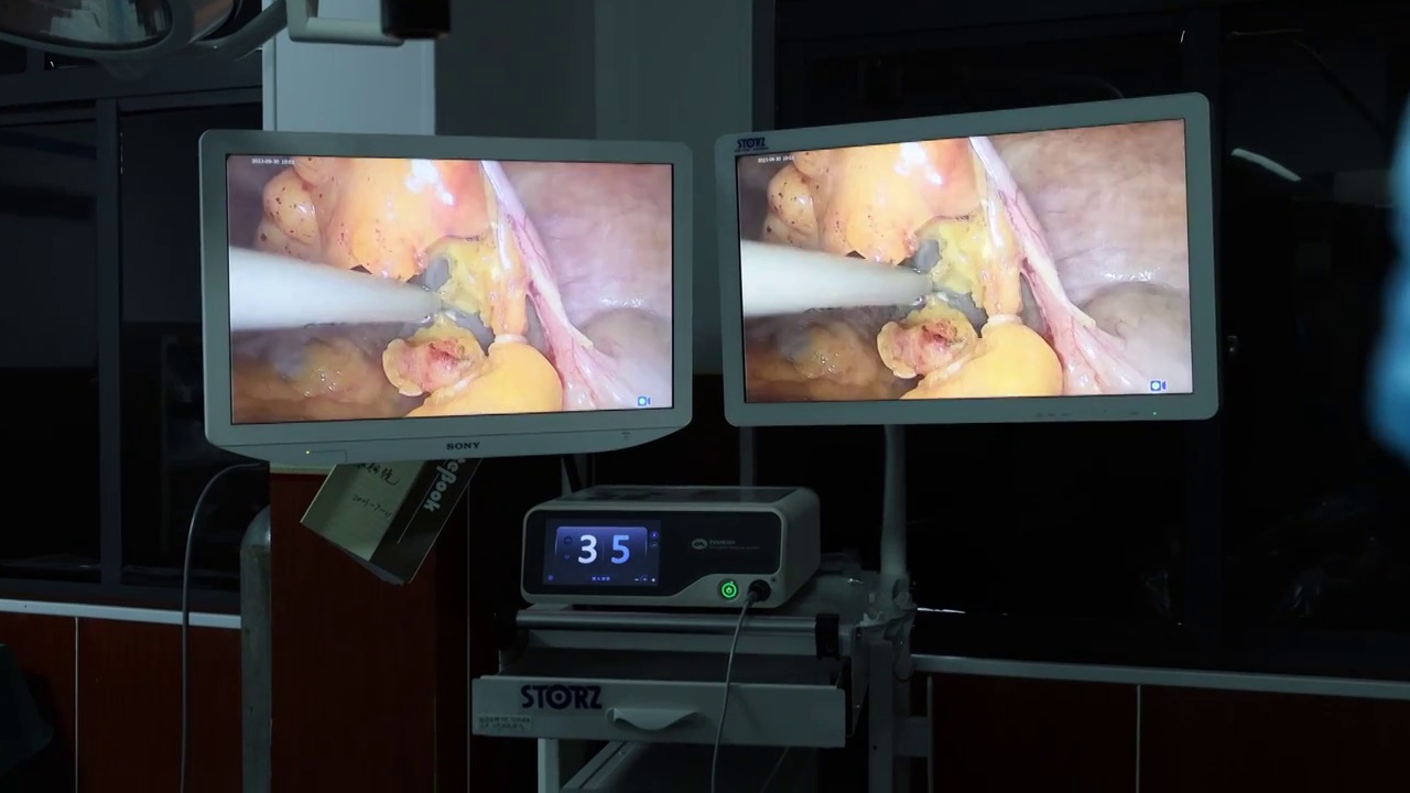 微创手术监视器画面视频下载