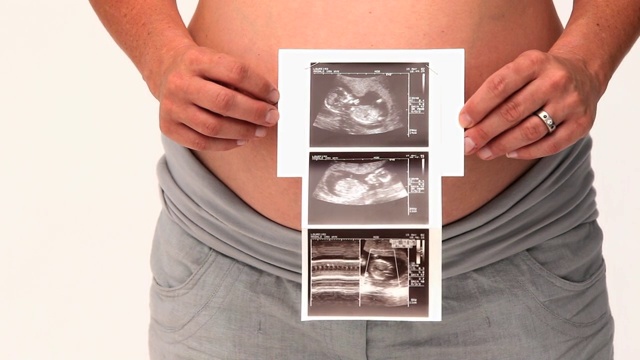 一个孕妇拿着一个扫描孤立的白色背景视频下载