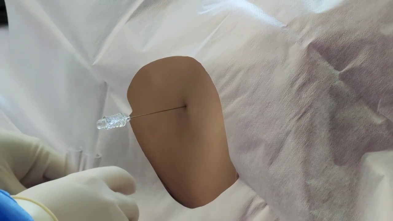 医疗脊髓穿刺手术视频下载