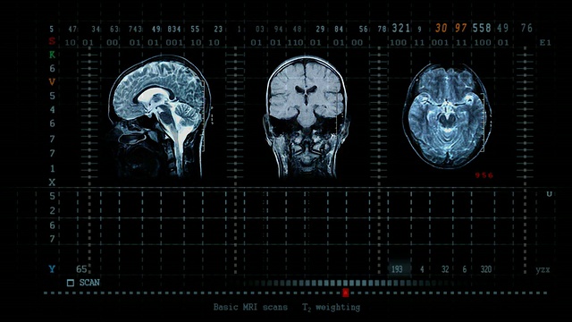 大脑扫描捷运视频下载