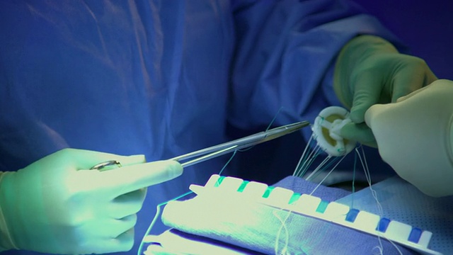 CU PAN外科医生与其他外科医生穿过心脏瓣膜/ Rockford，伊利诺伊州，美国视频下载