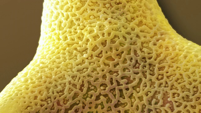 Leucospermum花粉粒。白种植物花粉粒的彩色扫描电镜(SEM)视频下载