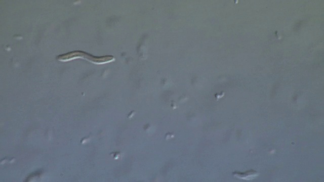 来自停滞池塘的细菌，包括弧菌。视频下载