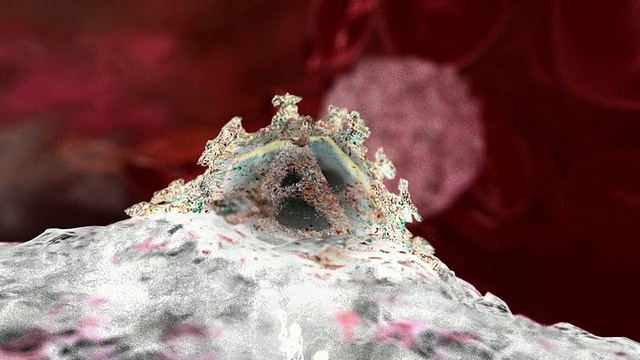 艾滋病毒粒子感染细胞。感染宿主细胞的HIV(人类免疫缺陷病毒)颗粒的动画视频购买