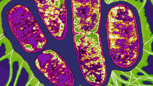 沙门氏菌。一簇沙门氏菌的彩色透射电子显微图(TEM)。视频下载