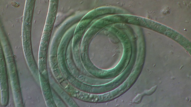 一种摆动动物细菌的毛状体(末端细胞)，在被细菌和食糜变形虫所覆盖的粘液基底上展开。差干涉对比延时电影显微摄影术视频下载
