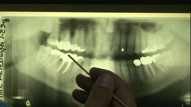 一名法医在检查牙科x光片。/美国视频下载