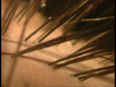 ECU，追踪黑色头发，显示与皮肤的交互作用视频下载