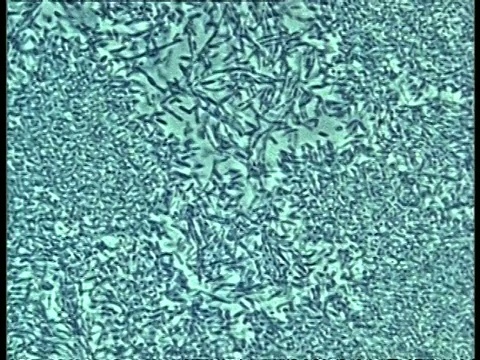 向上倾斜细菌移动的显微镜视图视频素材
