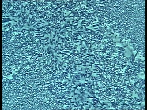 向上倾斜细菌移动的显微镜视图视频素材