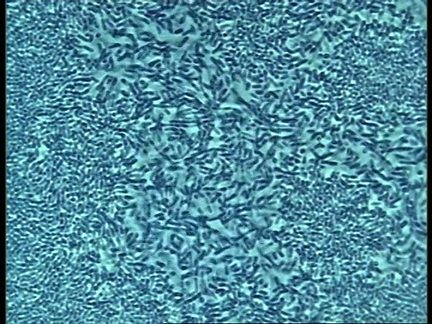 细菌移动的微观视图视频素材