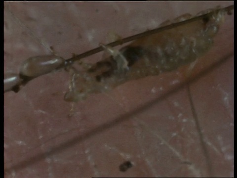 英国，一种母头虱，分泌胶水，在毛发中产卵视频素材
