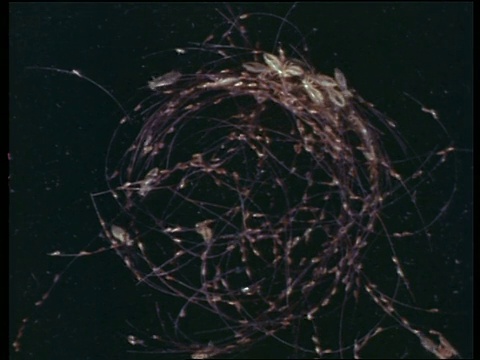 英国实验室实验，人类头发上的虱子和卵的显微照片视频素材