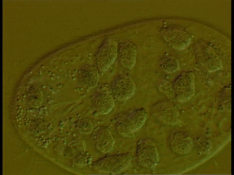 带有螺旋体细菌的纤毛虫的显微镜视图视频下载