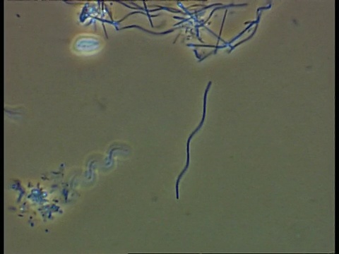 在池塘水中移动的细菌和鞭毛视频下载