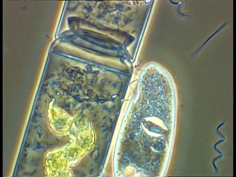 草履虫和螺旋体细菌在藻类细胞周围移动视频下载