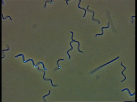 螺旋体细菌和其他在池塘水中移动的细菌。相衬视频下载