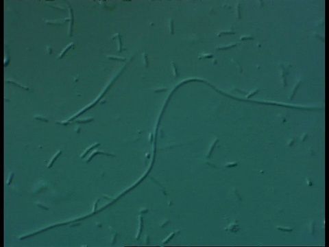 淡水养殖场池塘细菌的CU显微图视频下载
