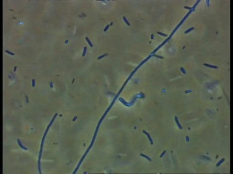 CU在淡水养殖场池塘细菌微观视图上的轨迹视频素材
