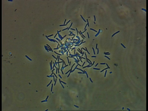 细菌CU显微图视频下载