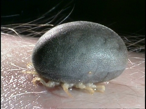 寄生虫/媒介-非洲蜱(鸟喙dorus moubata)在人类皮肤上的CU蜱视频素材