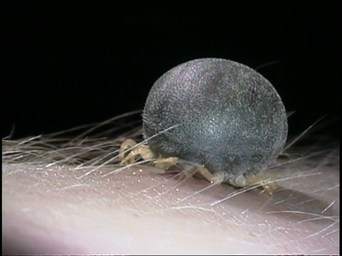 寄生虫/媒介-非洲蜱(鸟喙dorus moubata)在人类皮肤上的CU蜱视频素材